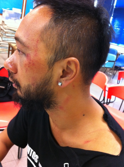 Ken Tsang injuries
