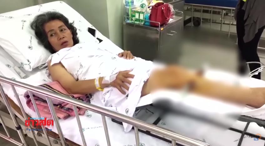Pimyanee Thanyawongsakul, 59, was sent to hospital after her leg was broken during a traditional Thai massage. Screenshot: Matichon TV