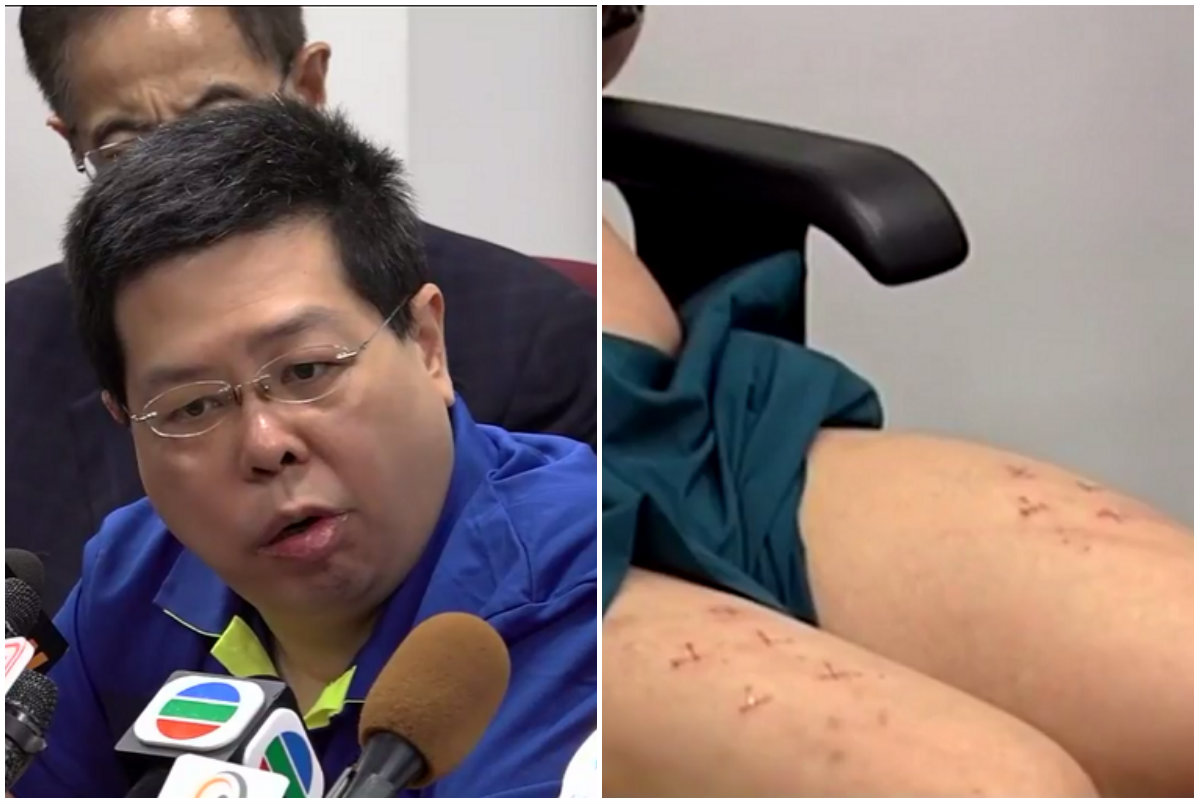 Lam (L) told reporters he had been beaten and interrogated by mainland Chinese agents. Screenshots: Apple Daily/Now TV via Facebook