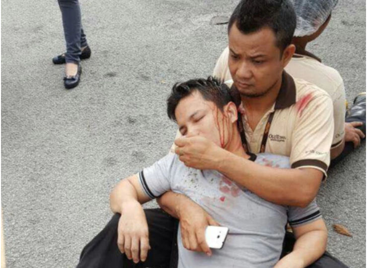 A worker being treated outside the blast via Malaysia Fire and Rescue Department 