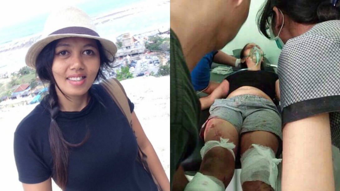 Balinese woman, Ni Putu Kariani, the victim of a horrific attack by her husband. Photos posted to GoFundMe on a page raising money for Kariani (link at the bottom of the page).