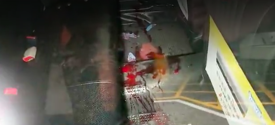 A 36-year-old man surnamed Che was taken to a hospital by a taxi driver following an attack in Wan Chai. This picture, from Apple Daily footage, shows inside the cab hailed by the injured man.