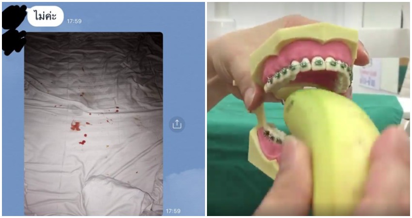A post-injury viral screenshot that the girlfriend allegedly sent to her dentist (left), and a screenshot from the warning video he created to warn others (right).
