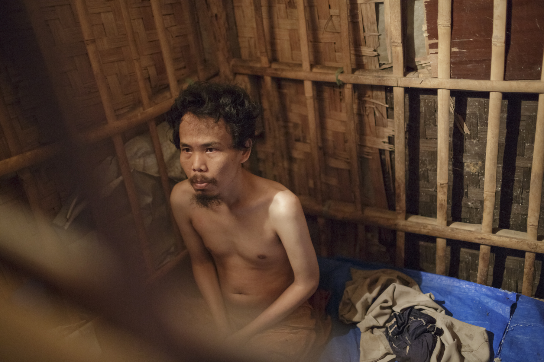 Sodikin, a 34-year-old man with a psychosocial disability who was shackled for more than eight years in a tiny shed outside the family home in Cianjur, West Java. Sodikin was released with the help of a local nongovernmental organization in May 2016. Photo: Andrea Star Reese for Human Rights Watch