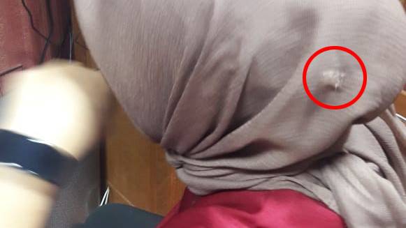 A bullet hole going through the hijab of an employee at Indonesia’s House of Parliament after a reported accidental shooting on October 15, 2018. Photo: Twitter