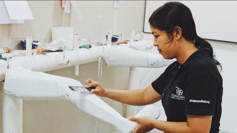 Tanty working on a plaster cast for a prosthetic in the Puspadi lab. Photo: Julianne Greco/Coconuts Bali