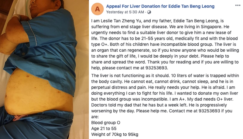 Photos: Appeal For Liver Donation for Eddie Tan Beng Leong/Facebook