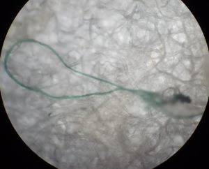 A blue plastic fiber found inside a fish’s stomach. Photo: Marine National Park Operation Center Trang 3 / Facebook