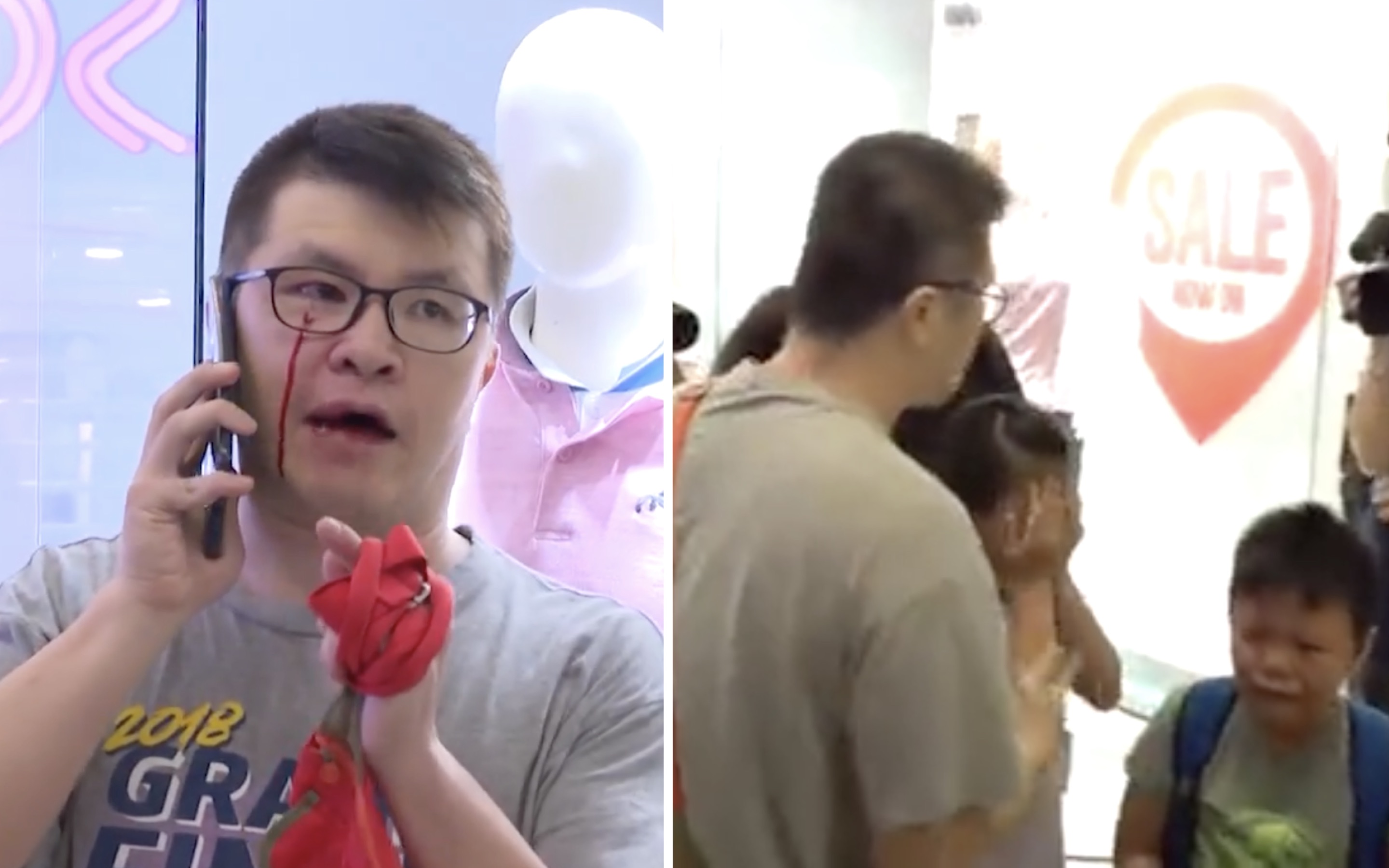 (Left) A 40-year-old man surnamed Lee with a cut under his eye after getting involved in a scuffle with pro-democracy supporters at a mall in Kowloon Bay. Lee started singing the Chinese National anthem during a flash sing-along at the mall. Screengrabs via Apple Daily video.