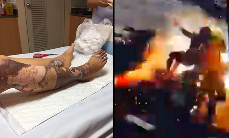 Malini Wirasuchart’s leg was severely burned when an overhead power line fell on her in Korat, at left. At right, a still image of the explosive moment the cable dropped. Photos: Ester Chill / Facebook  