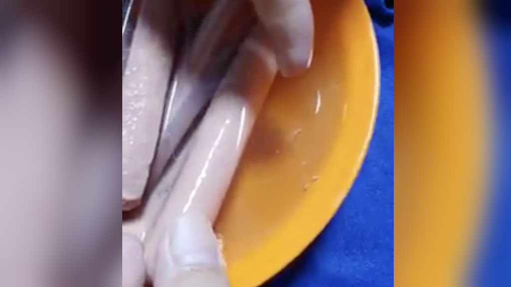 Man pointing at purported white worms from chicken hotdogs. Photo: All Singapore Stuff/Facebook