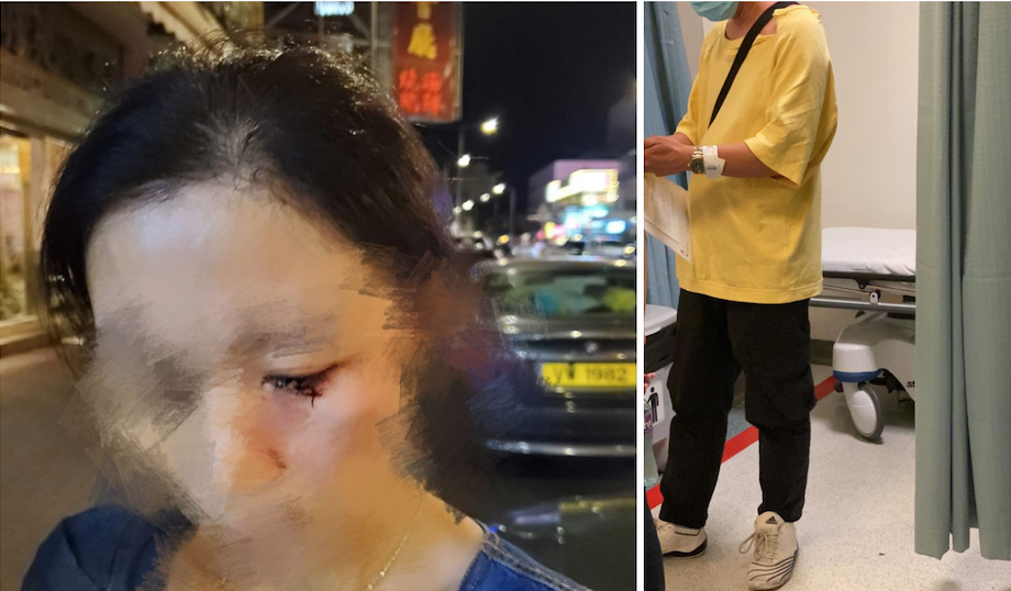 The owner of Jade Restaurant and his wife were injured by attackers in Yuen Long on June 28, 2020. Photos via Facebook/Kizz Lau and Facebook/Tommy Cheung